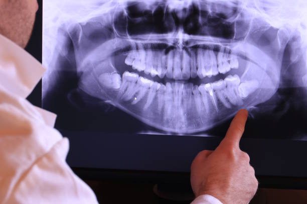 Best Weekend Emergency Dentist in Tioga, ND