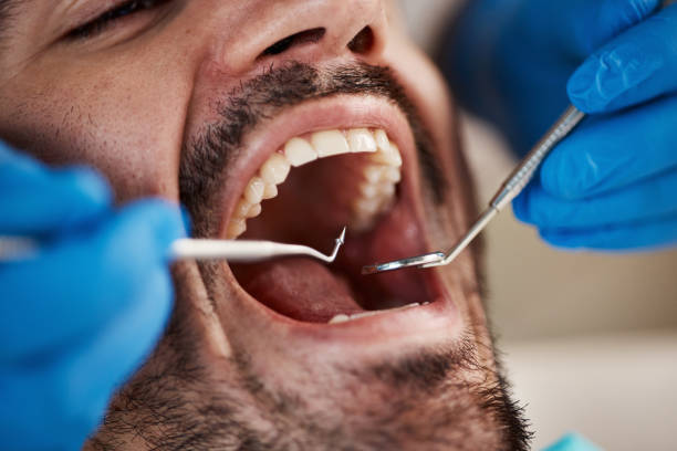 Best Walk-In Emergency Dentist in Tioga, ND