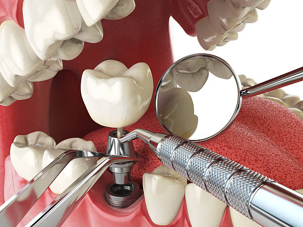 Best Emergency Treatment for Toothache in Tioga, ND